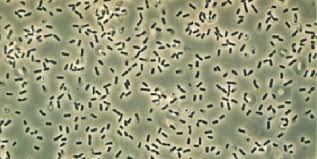 Bacillus Subtilis